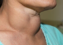 Understanding Your Thyroid: An Overview of Thyroid Functions and Disorders