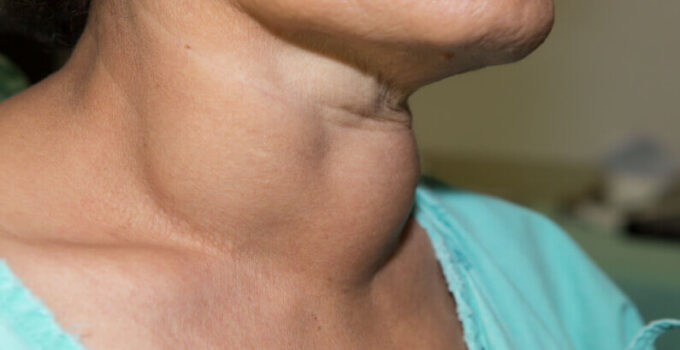 Understanding Your Thyroid: An Overview of Thyroid Functions and Disorders